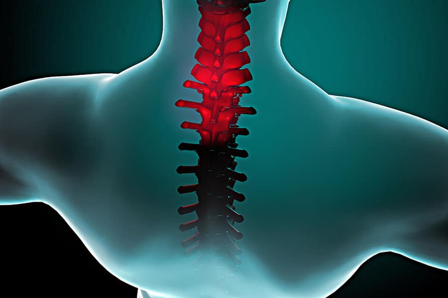 Stiff Neck Causes and Treatments - Featured Image