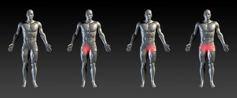 groin-pain-when-walking-what-to-do-and-when-to-worry-pain-doctor