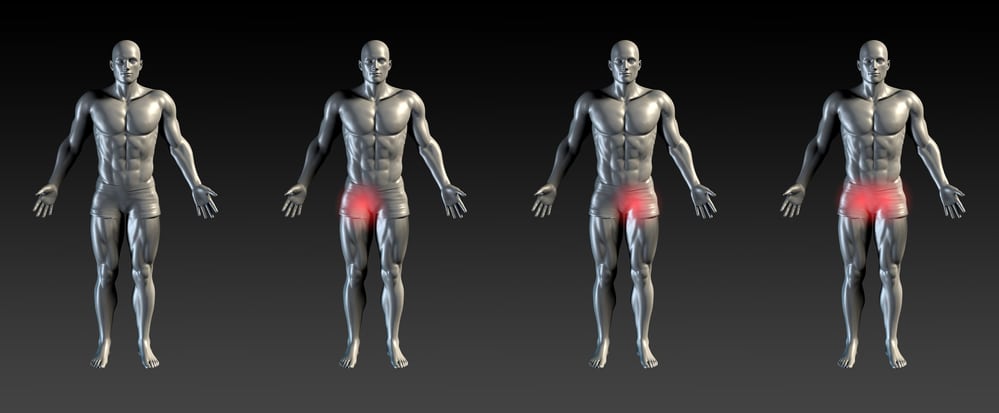 groin-strain-motus-physical-therapy