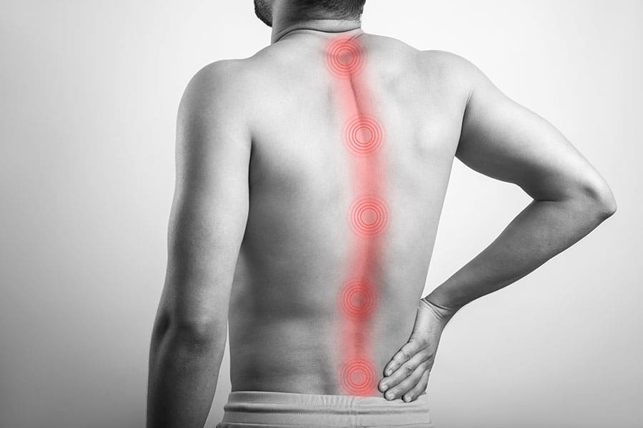 spinal cord stimulation procedure