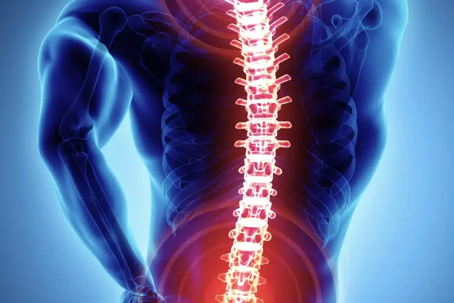 Discography Arizona Pain and Spine Institute Pain Doctor