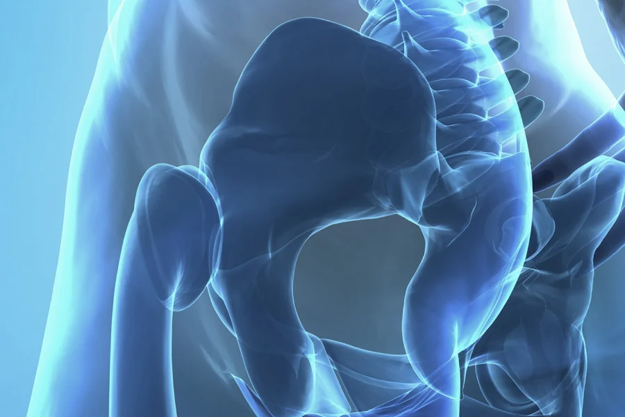 Sacroiliac Joint Injections - Image