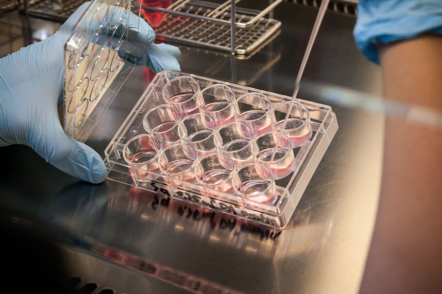 amniotic stem cell therapy for dehydration